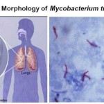 Habitat-and-Morphology-of-Mycobacterium-tuberculosis